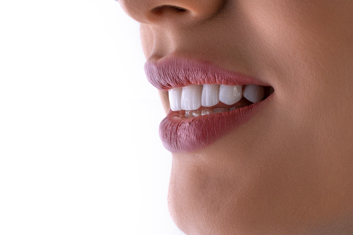 Smile gallery
